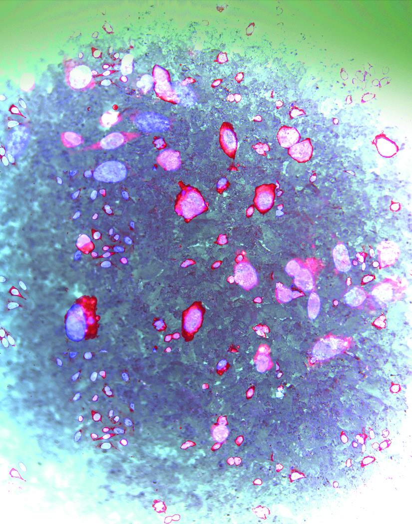 Subterfuge<br />
Axiovision image analysis<br />
Joanna Shisler and Ed Roy&nbsp;<br />
Joanna Shisler Laboratory<br />
Ed Roy Laboratory<br />
Funded by the NIH