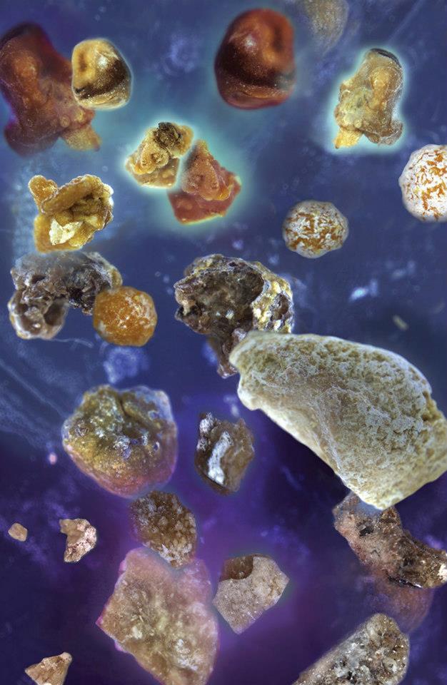 Cosmic kidney stones<br />
Microscope Zeiss Axiozoom V16 Scope