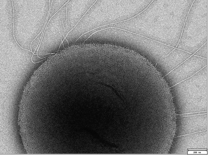 Study of archaeal cells could teach us more about ourselves