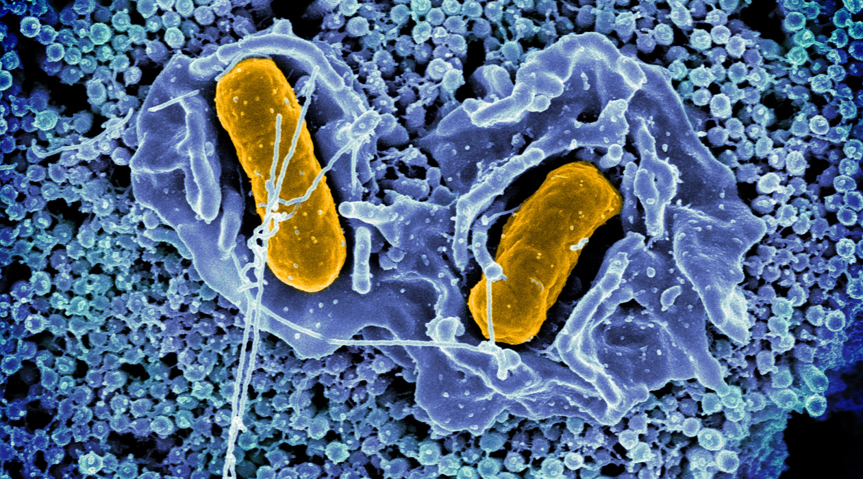 Scanning electron micrograph of Salmonella Typhimurium invading a human epithelial cell. S.Typhimurium has been decreasing in prevalence due to vaccinations by the poultry industry. Photo credit: National Institute of Allergy and Infectious Diseases