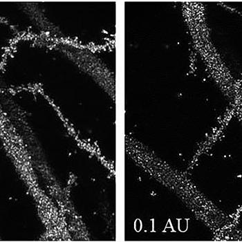 Golgi-Cox impregnated murine hippocampal neurons
