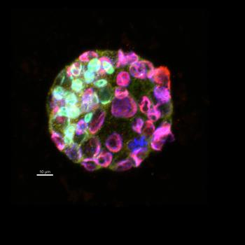 This embryo is part of a study to identify the effects of DEHP, which is a plasticizer whose chemical structure closely  resembles hormones and is believed to be an endocrine disruptor. 