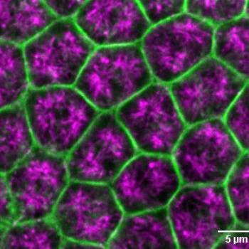 This image demonstrates a surface view of Drosophila embryo undergoing cellularization, depicting microtubule in magenta and Actin in green.