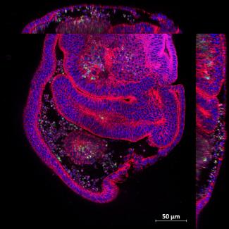 The image showcases regenerating tissue from Drosophila larval wing imaginal disc, captured in a top-down (XY) view alongside orthogonal views (YZ and XZ planes). The tissue is stained to highlight different structures: DAPI marks nuclei (blue), actin highlights the cytoskeleton (red), the plasma membrane is shown in magenta, and dying cells are labeled in green.