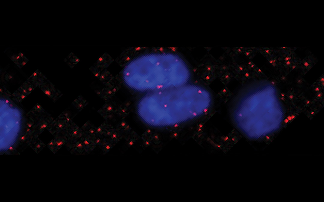 The breast cancer cells' nuclei are illuminated (blue) by quantum dots and individual EGF growth factors appear as red spots.