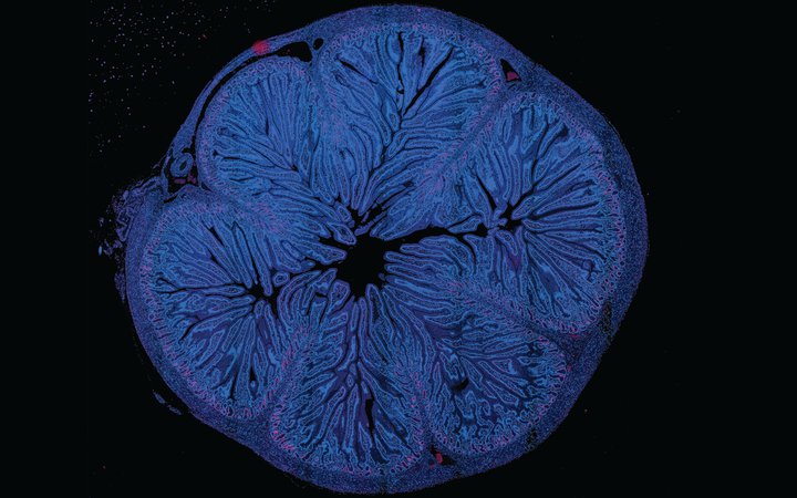 Inward growth<br />
Nanozoomer Slide Scanner