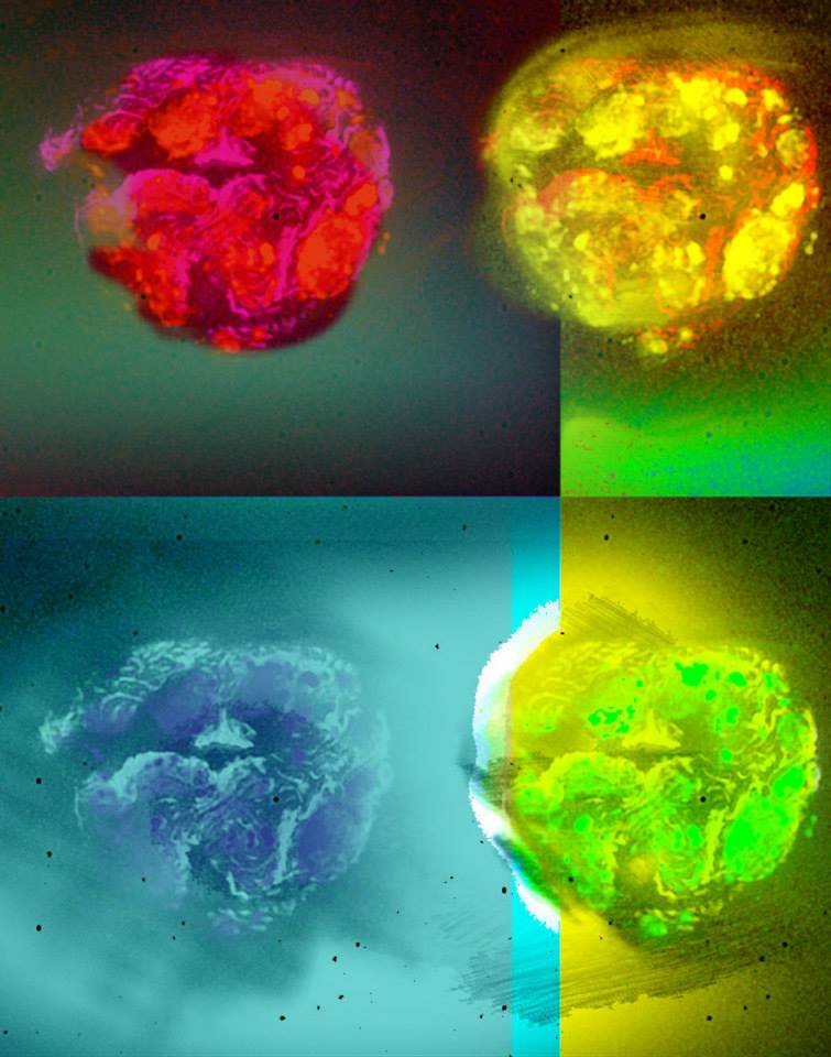 Fire at will<br />
SR-SIM Four laser structured Illumination system