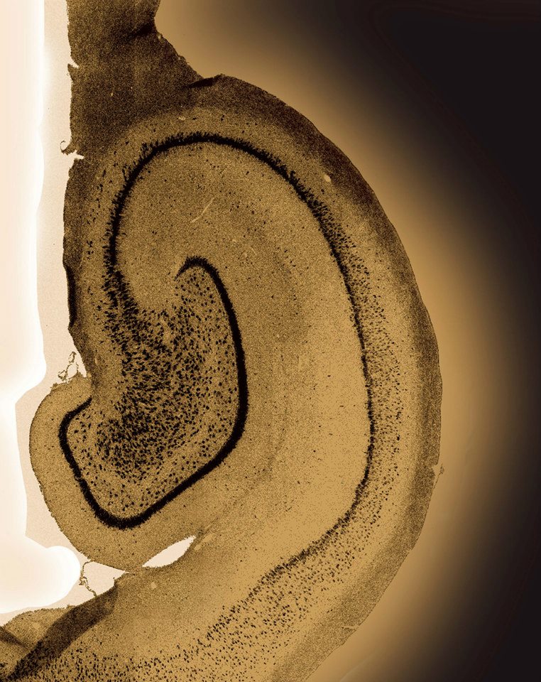 Food for thought<br />
Zeiss LSM 700 Confocal - four laser point scanning confocal with a single pinhole