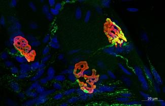 Three neuromuscular junctions (NMJs) from the diaphragm of a young male rat, illustrate the complex connections between motor neurons and muscle fibers that facilitate precise control of muscle contractions for breathing.