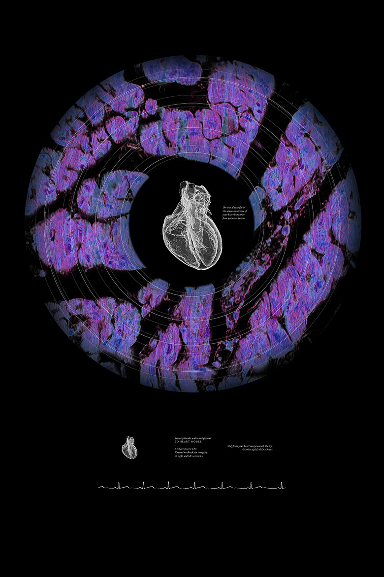 Joy's Bonfire<br />
Scientist Collaborator&nbsp;Joanne Vanessa Hwang<br />
Hyunjoon Kong Laboratory Group<br />
X5000 NSI High Resolution CT and rendered in 3D using Imaris 3D