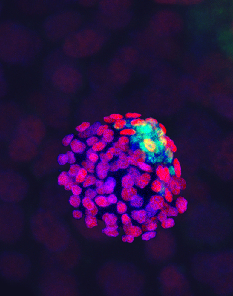 Zeiss LSM 880 Microscope with Airyscan<br />
Rachel Braz Arcanjo<br />
Romana Nowak Laboratory<br />
Funded by the National Institutes of Health and Science Without Borders